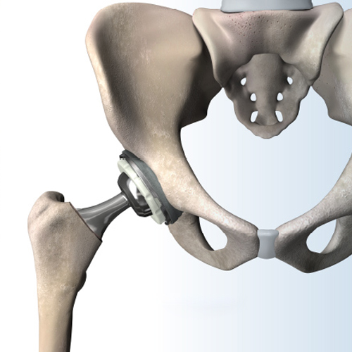  mako robotic surgery