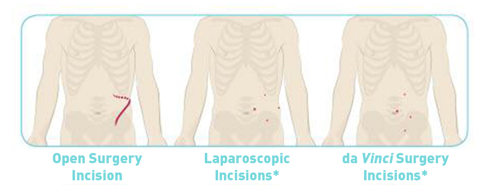 Kidney and Urology Reconstructive Surgery